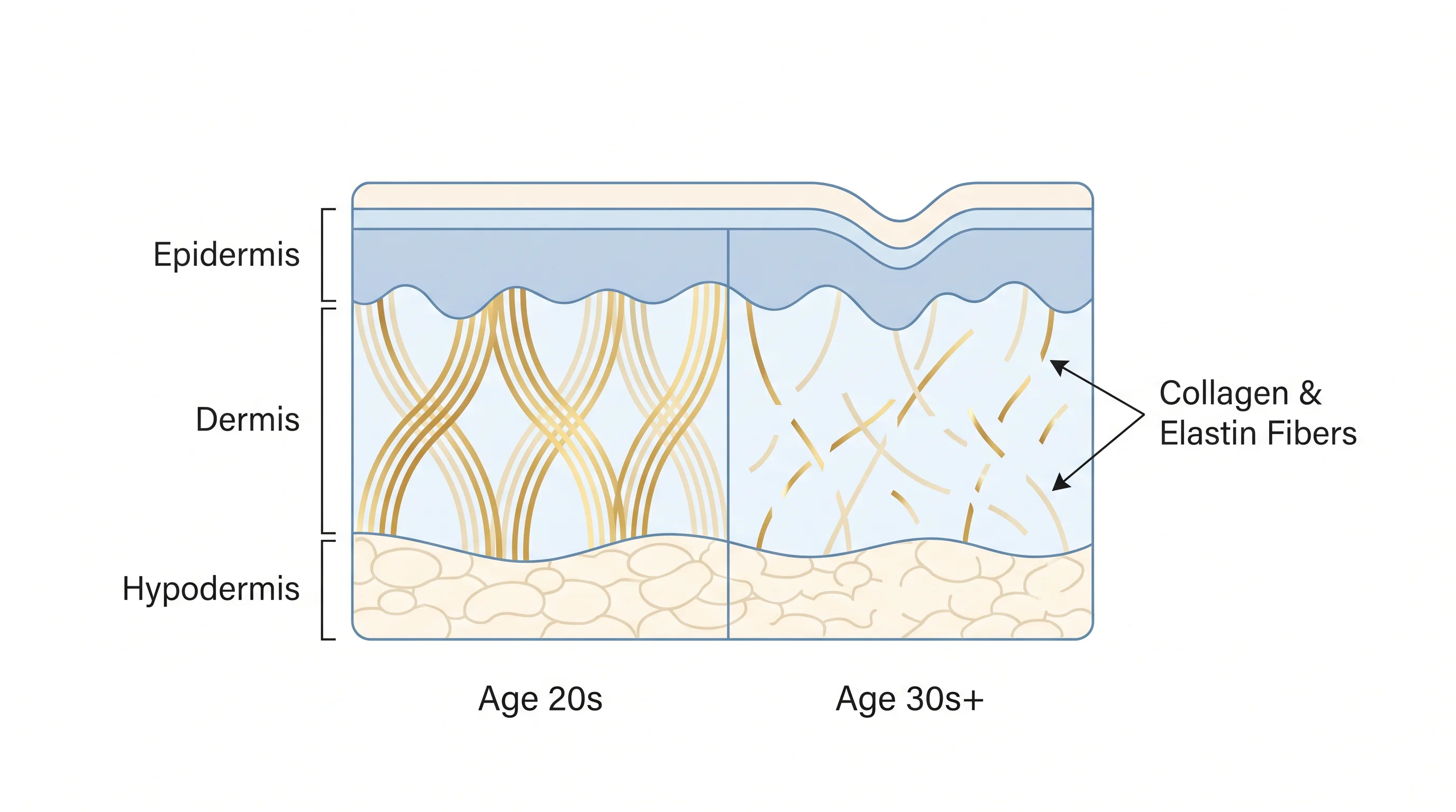 Diagram showing collagen fiber density in skin at Age 20s vs Age 30s+